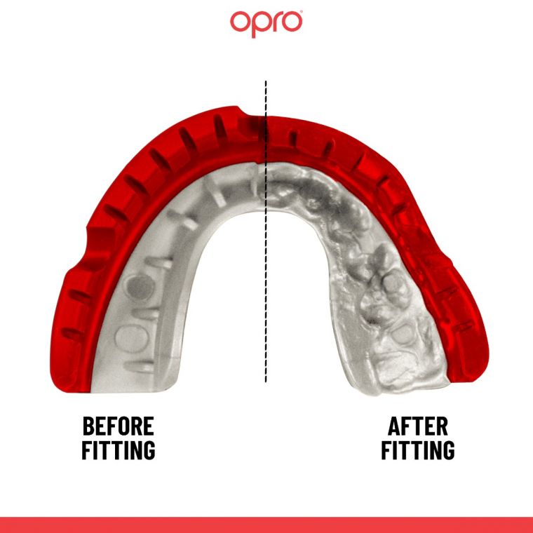 Opro Gold Level Mouthguard for Braces (Age 10+)